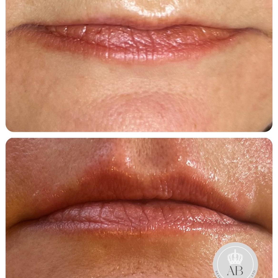AB Beauty Aesthetics image 3