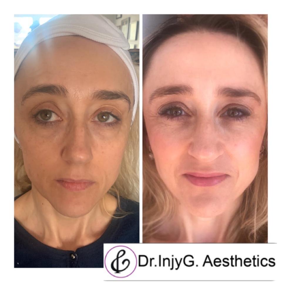 Dr Injy G Aesthetics Guildford image 2