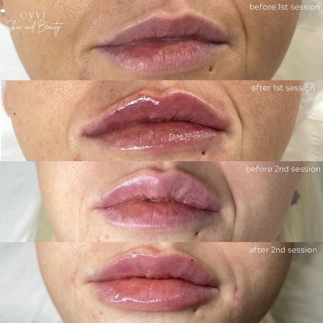 Eyvi skin and beauty image 3
