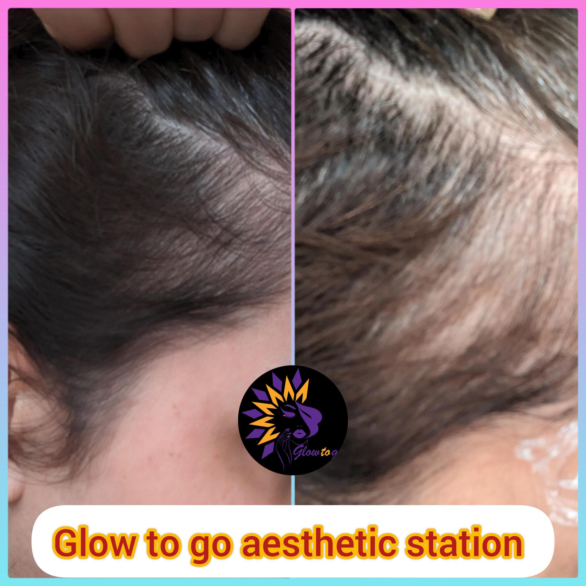 Glow to go aesthetic station image 3