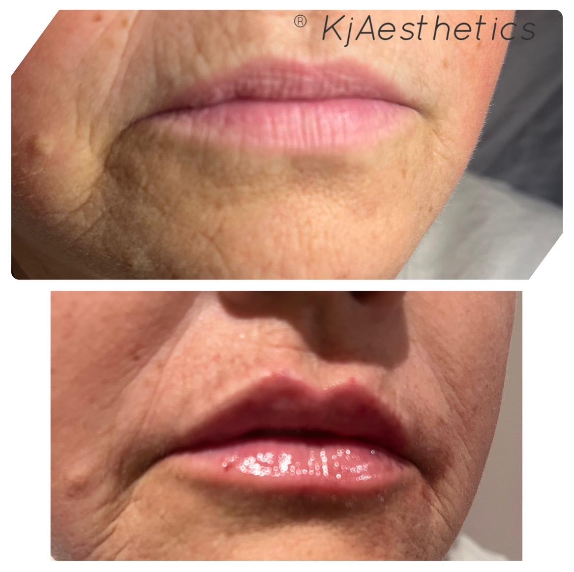 KjAesthetics image 2