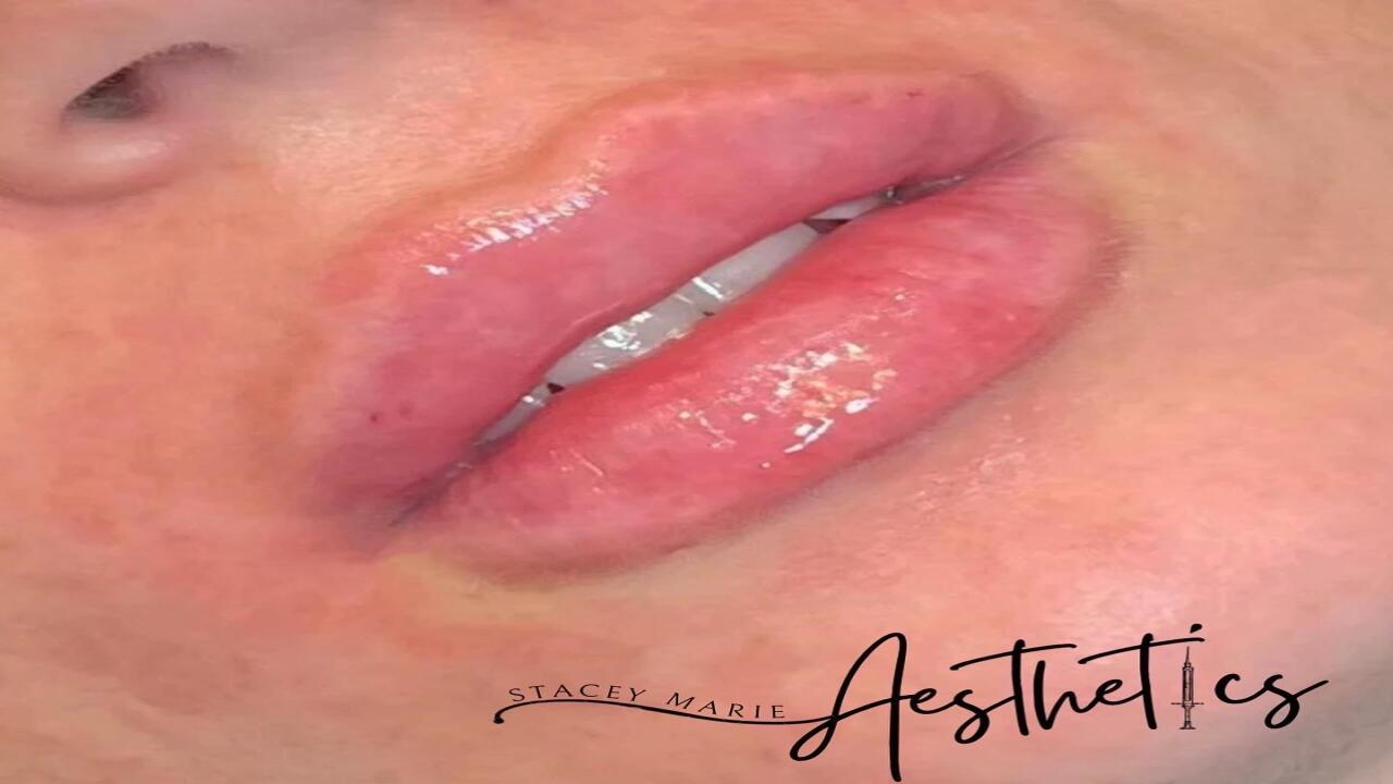 Stacey Marie Aesthetics image 1