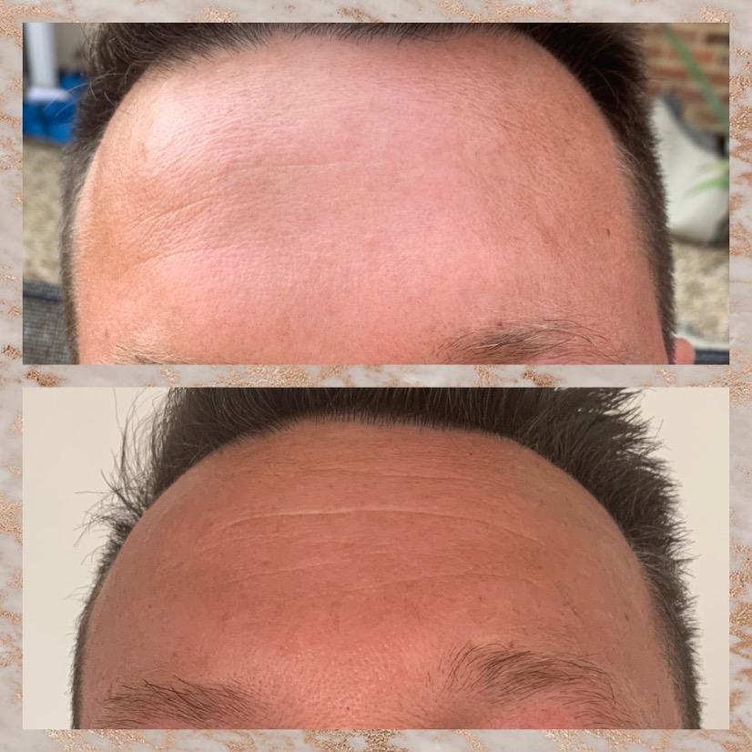RISE Aesthetics UK image 3