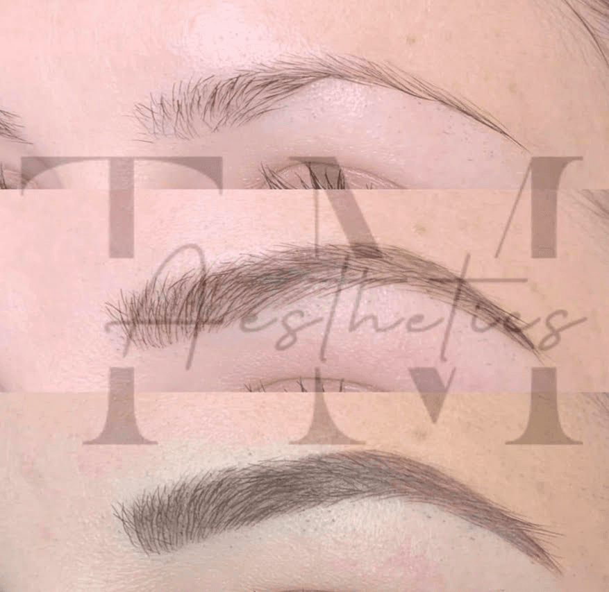 Tara Mason Aesthetics image 3