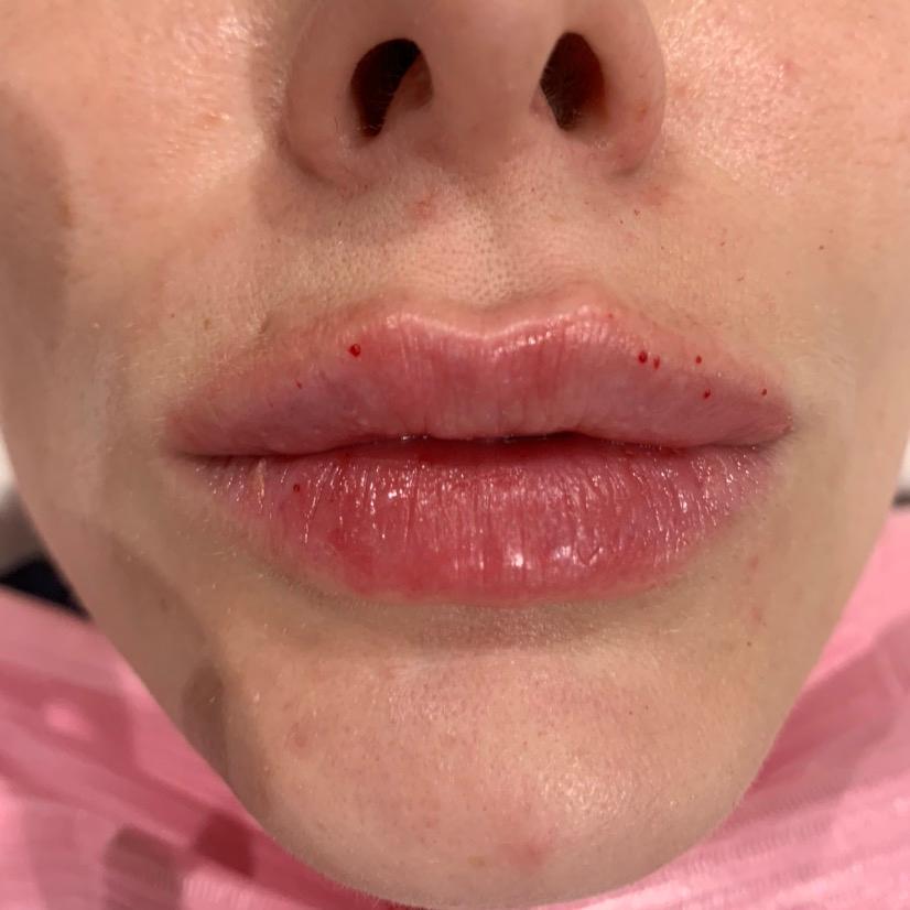 LVAesthetics image 2