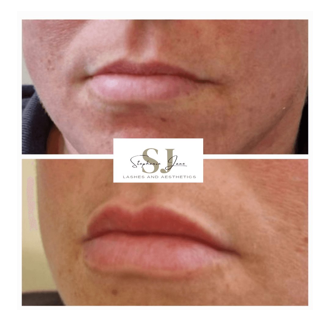 SJ Lashes and Aesthetics image 3