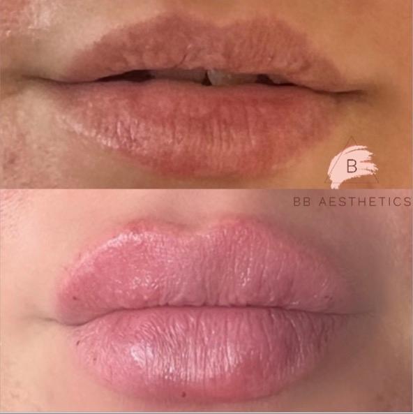 BB AESTHETICS BROUGHTON CLINIC image 2