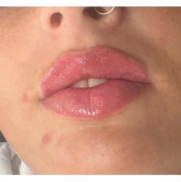 BB AESTHETICS BROUGHTON CLINIC image 1