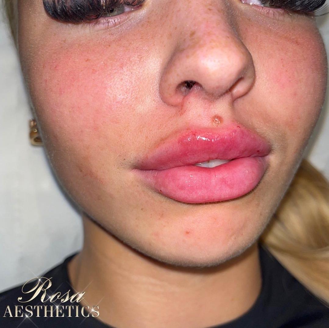 Rosa Aesthetics image 2