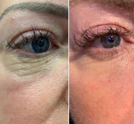 SkinFit Face & Body Clinic image 2