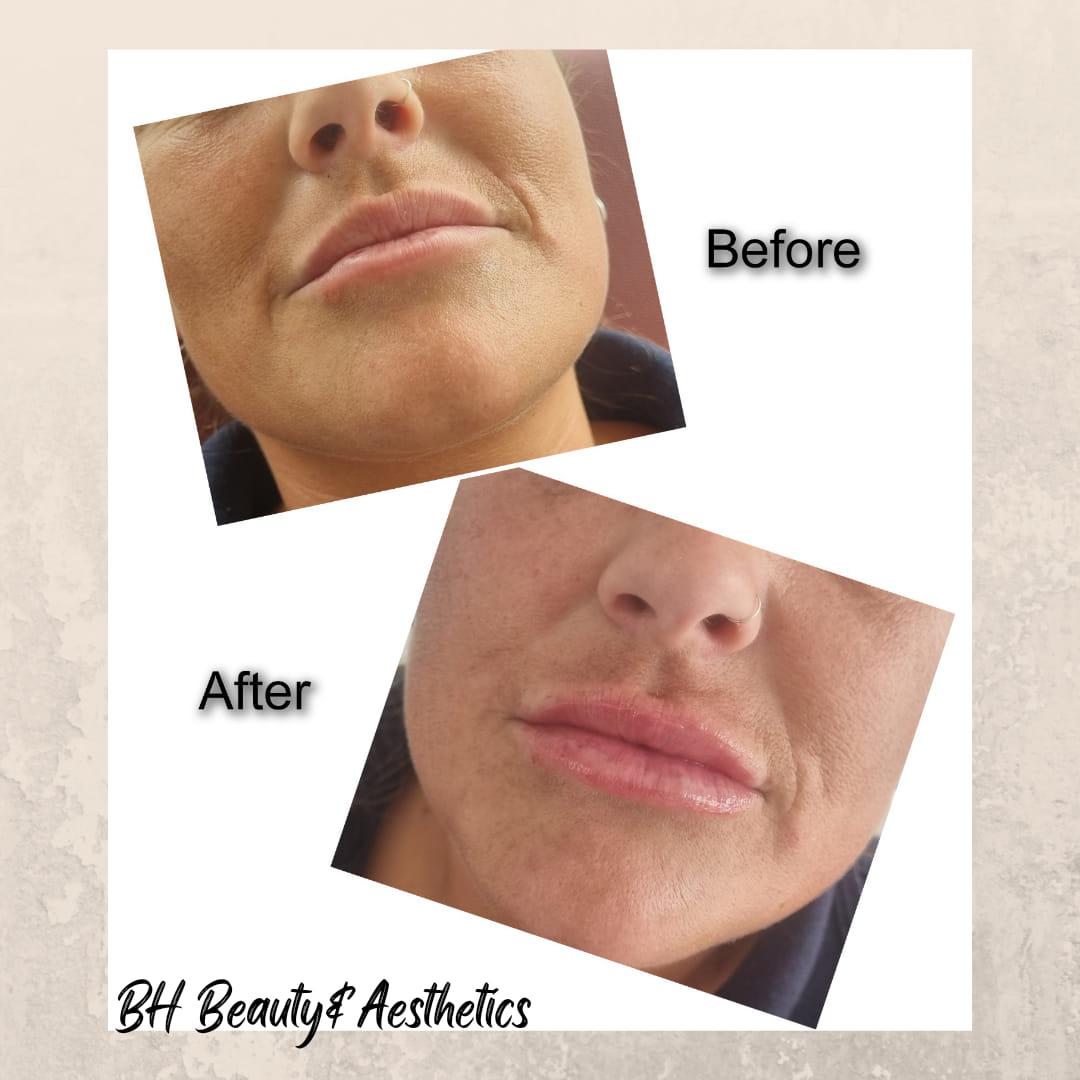 Bh beauty image 3