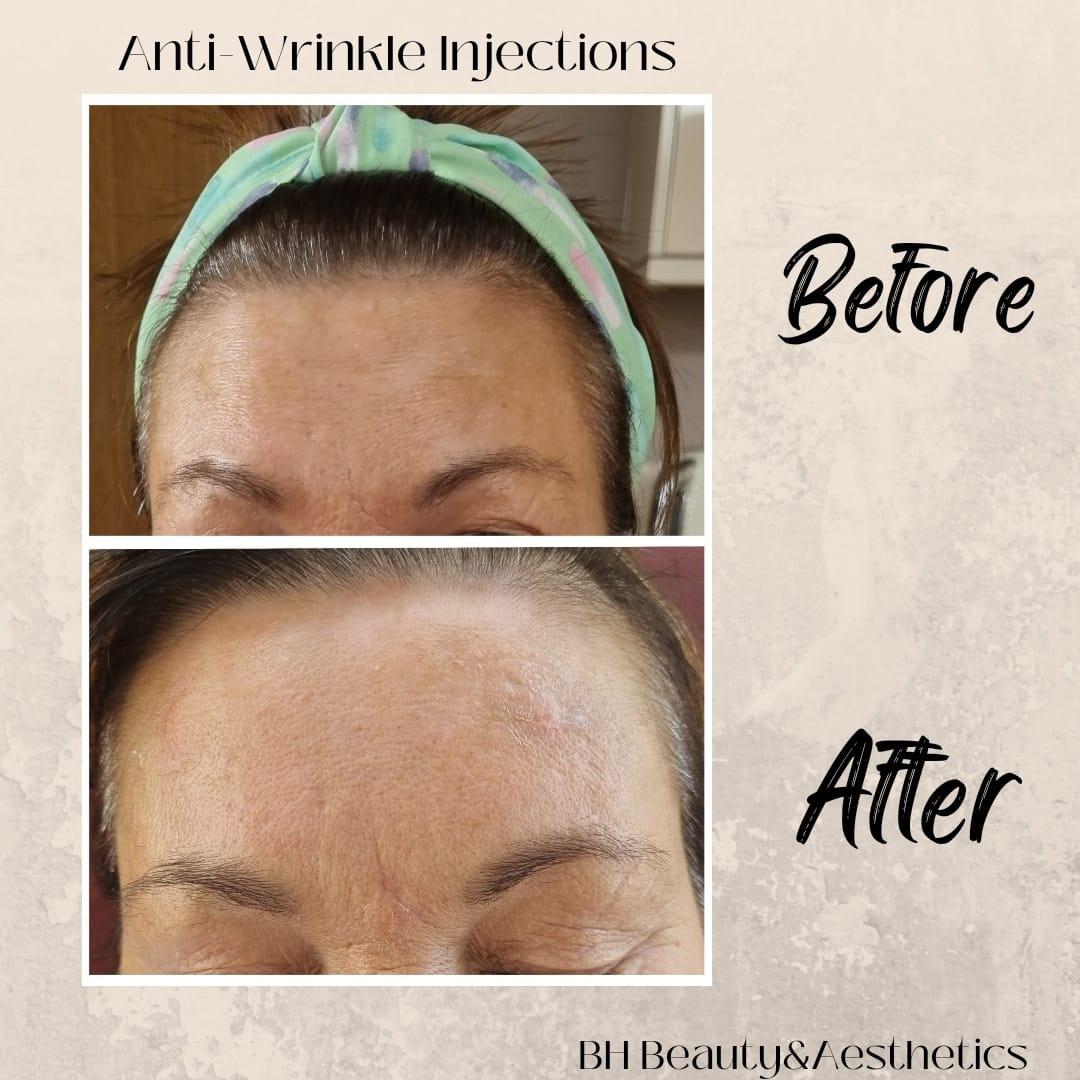 Bh beauty image 2
