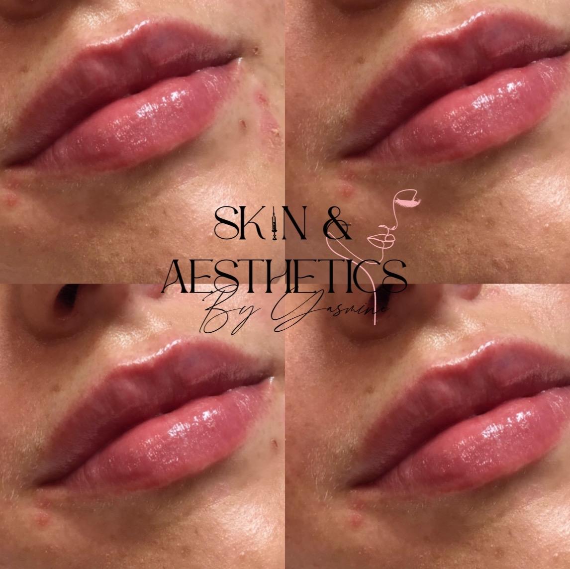 Skin by Yasmine image 2