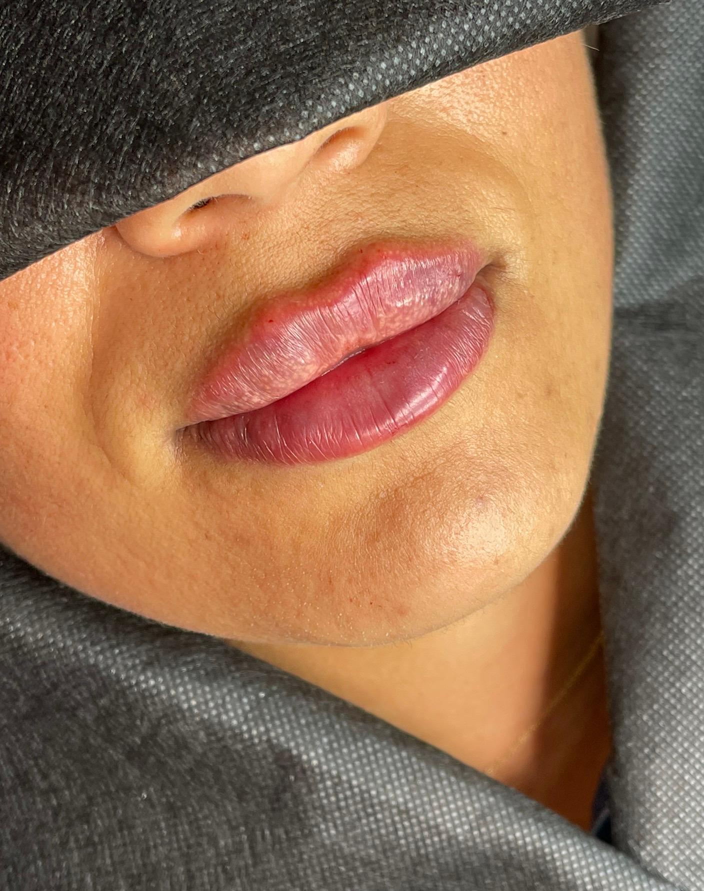 Luxeaestheticsuk image 1