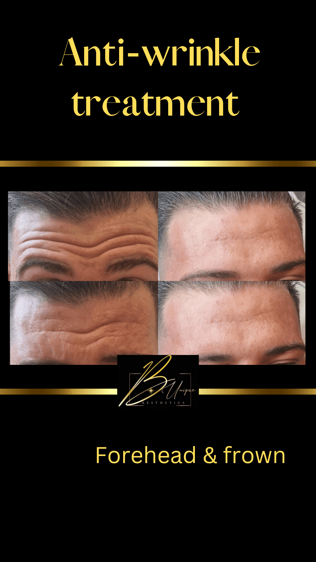 B unique aesthetics image 2