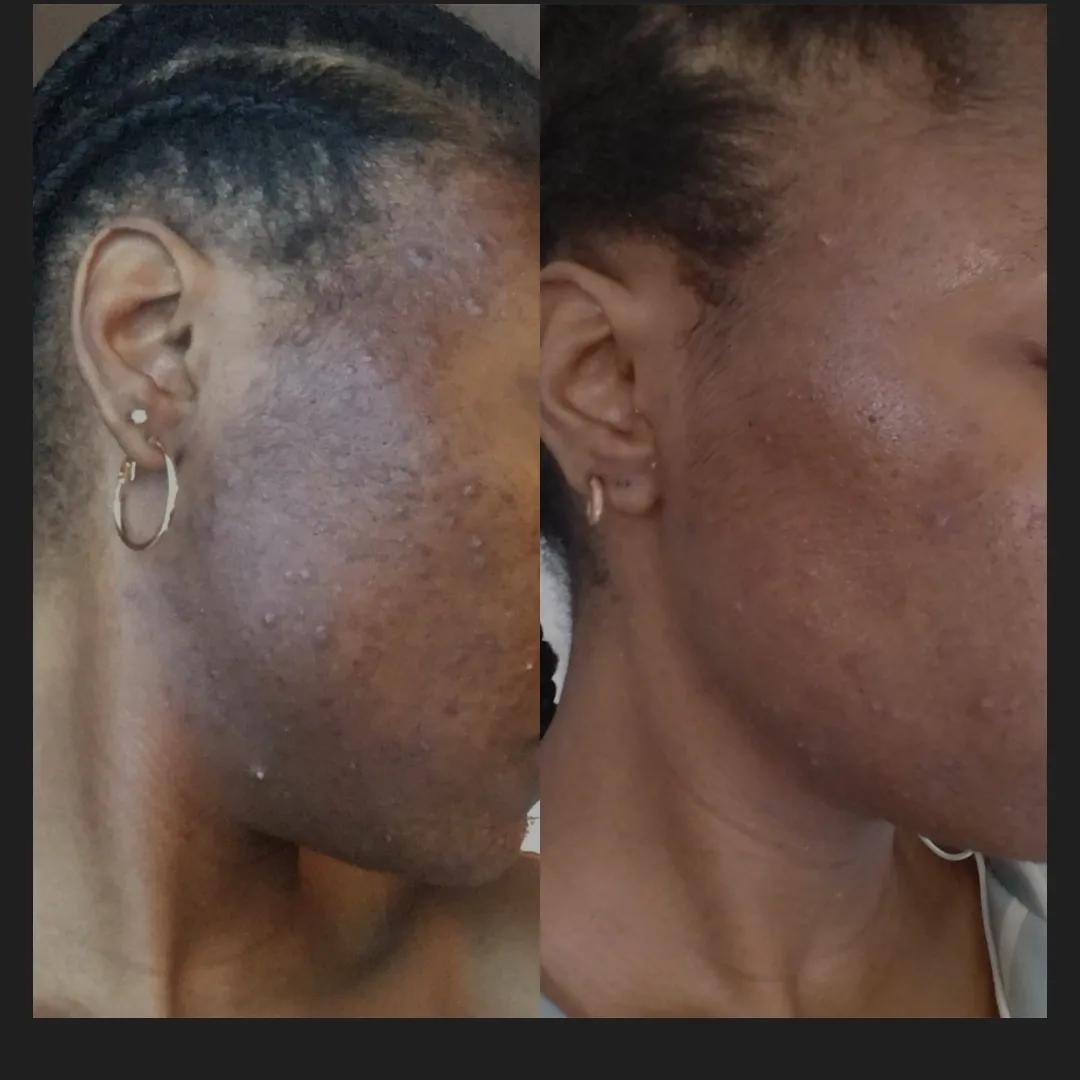 McQueens Aesthetics within Salmas Salon image 3