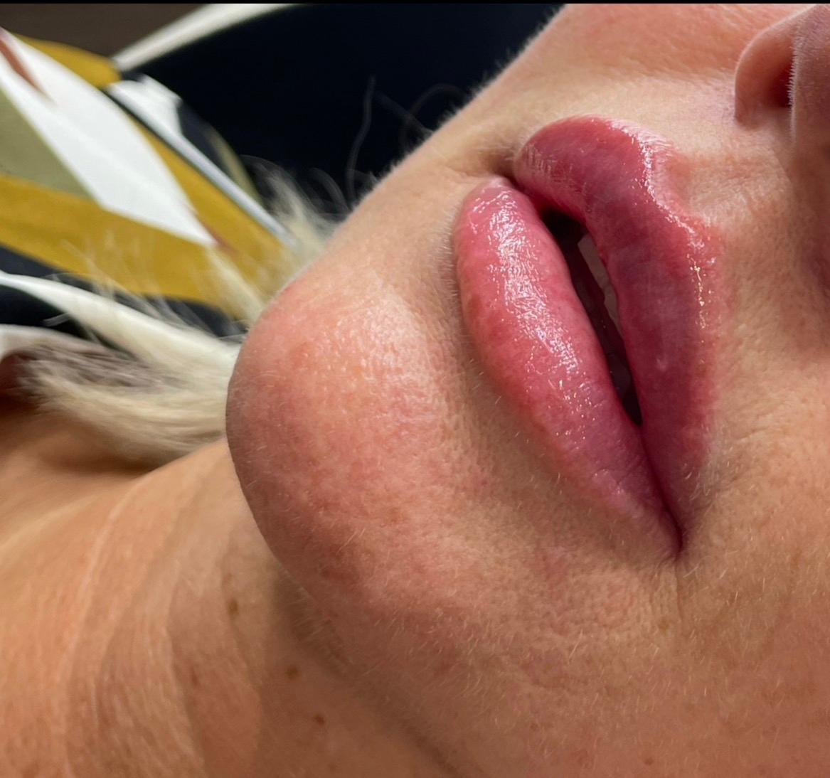 CLI Aesthetics image 3