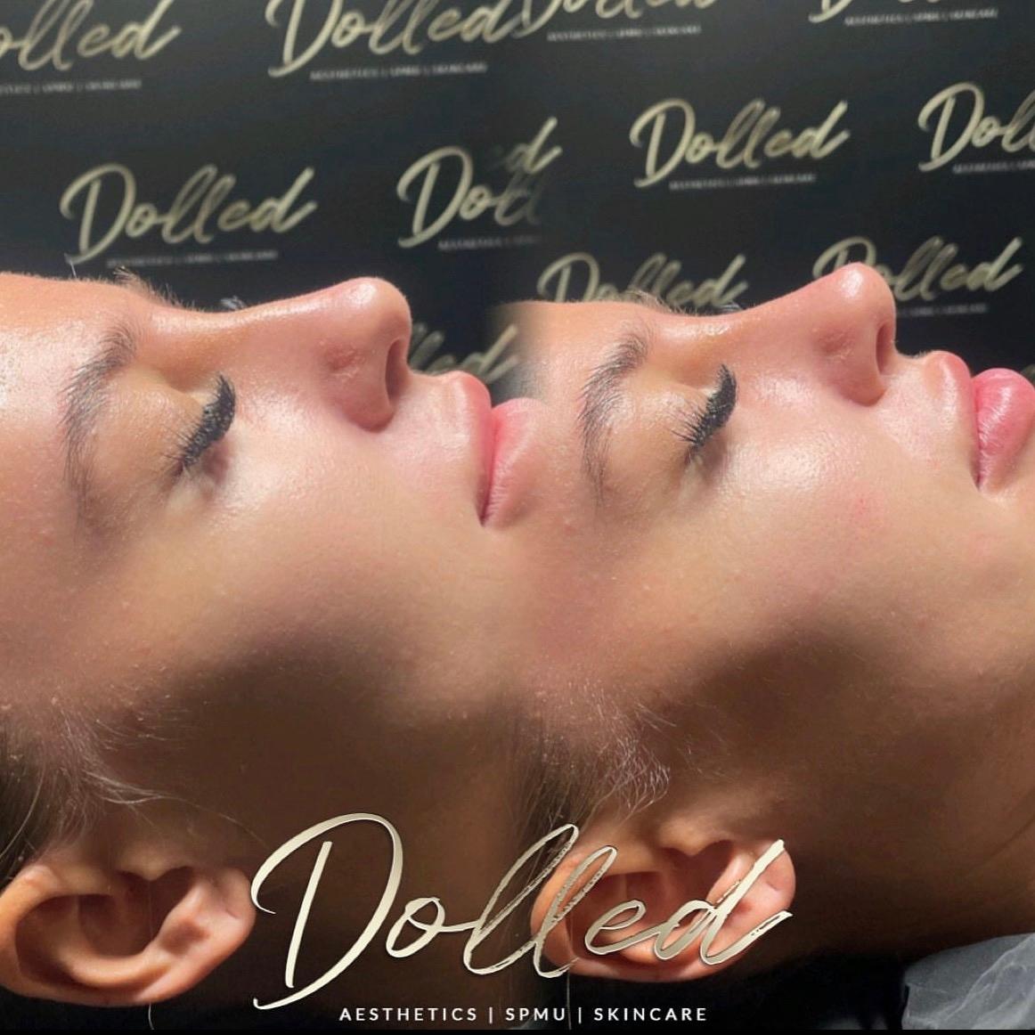 Dolled Aesthetics LTD image 3