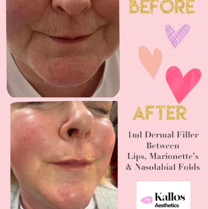 Kallos Aesthetic Clinic image 3