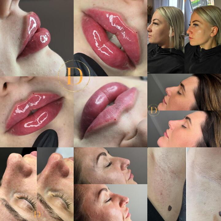 D Aesthetics and Laser image 3