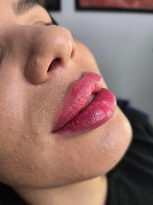 D Aesthetics and Laser image 1