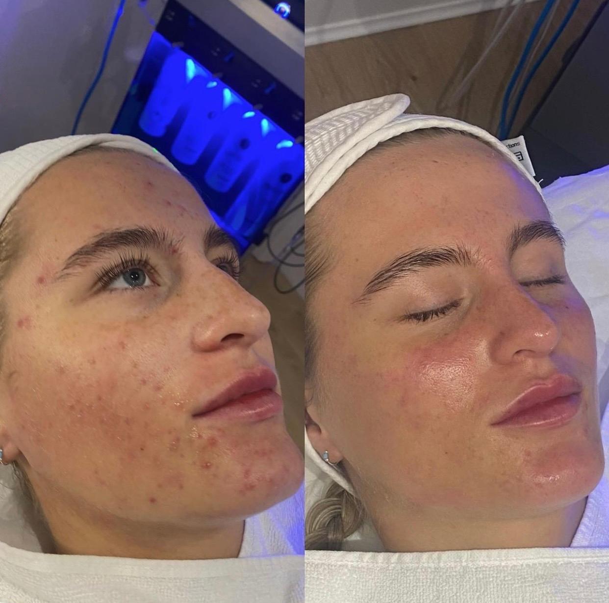 IndermaUK image 2