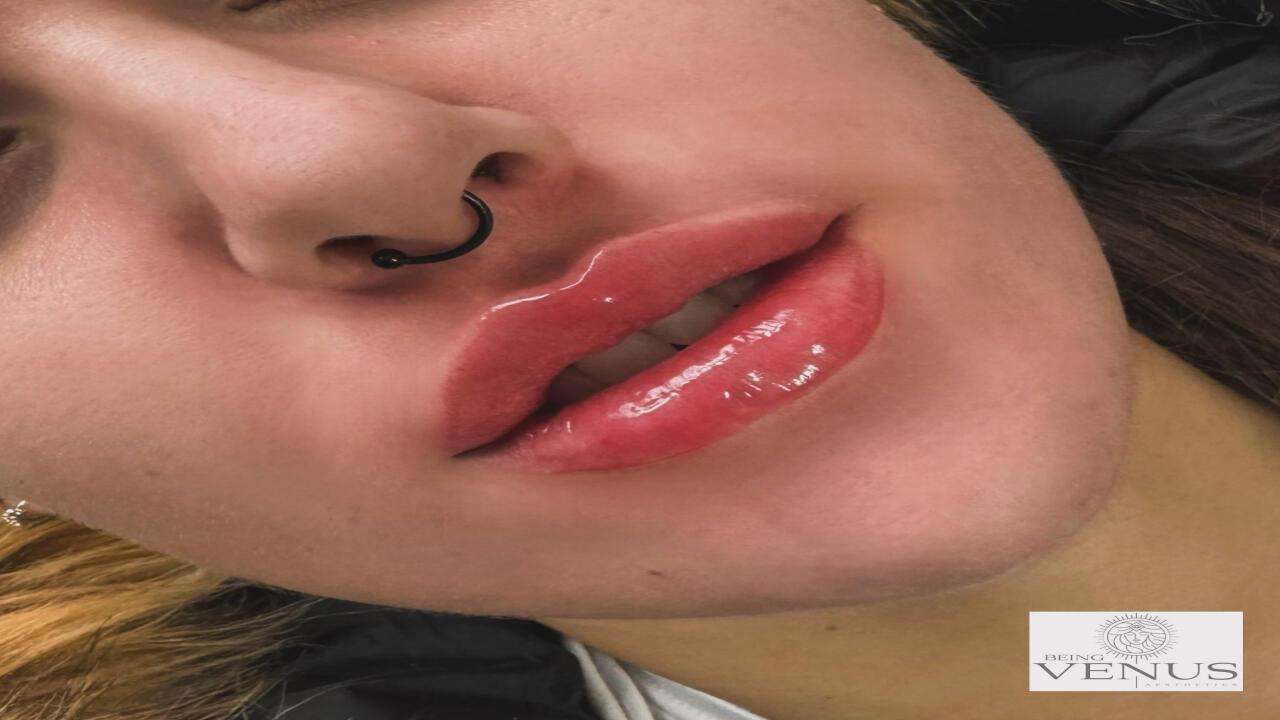 Being Venus Aesthetics image 1