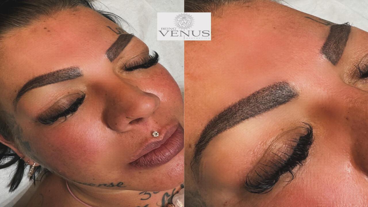Being Venus Aesthetics image 3