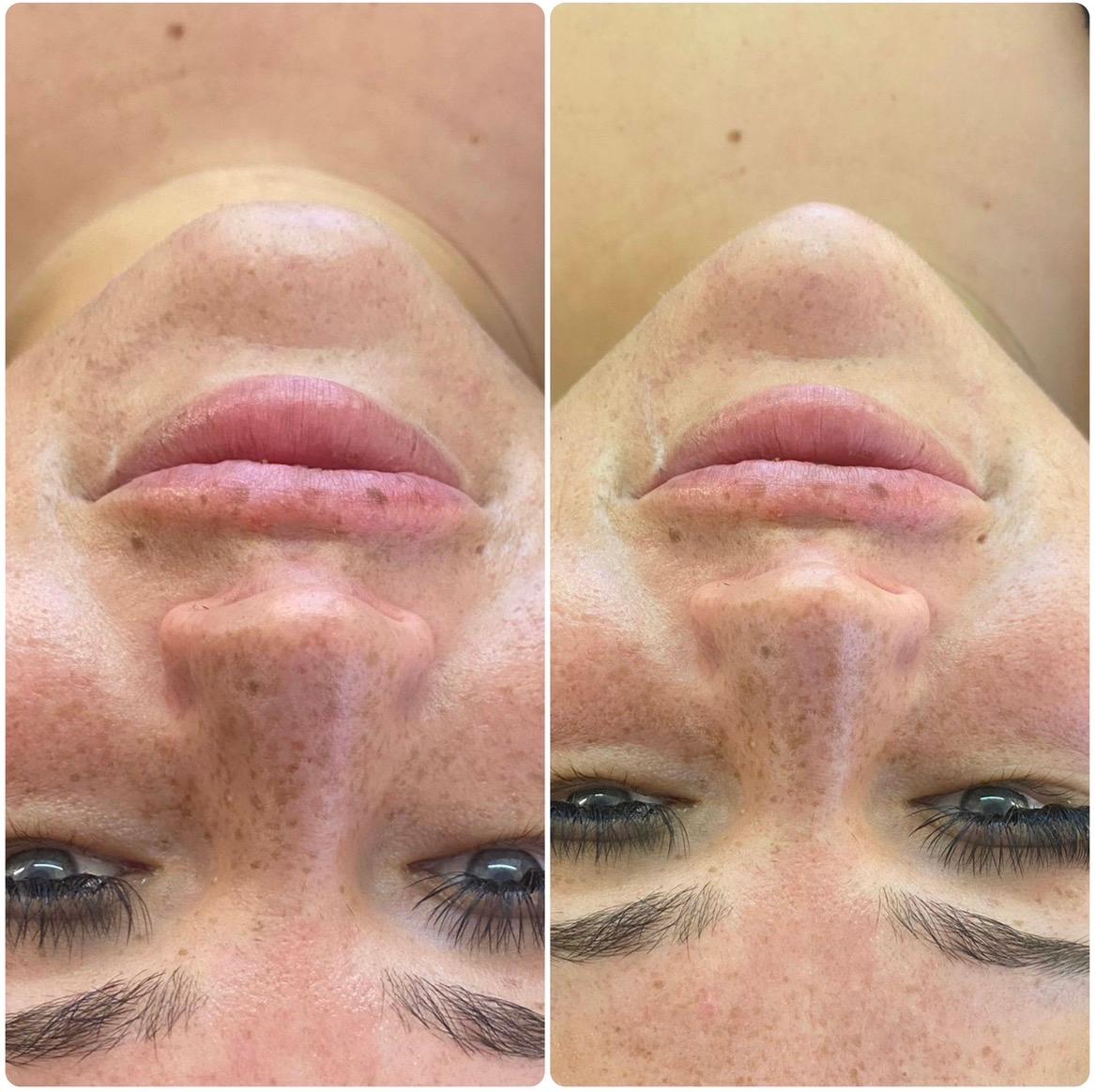 Rejuvenate Aesthetics image 2