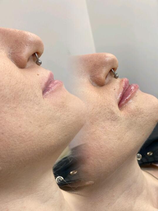 The lip lab image 3