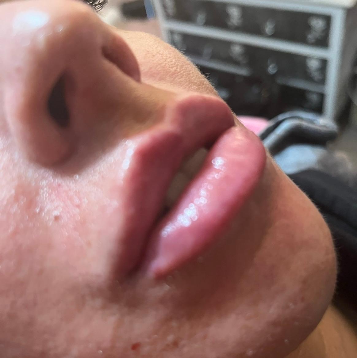 Kennedy aesthetics image 1