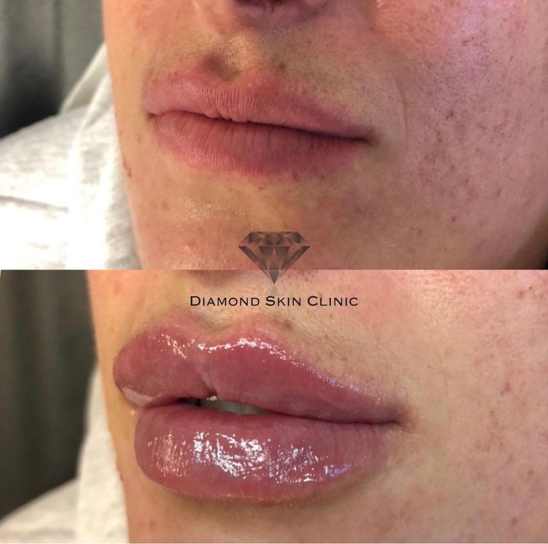 Diamond Skin Clinic Ltd image 3