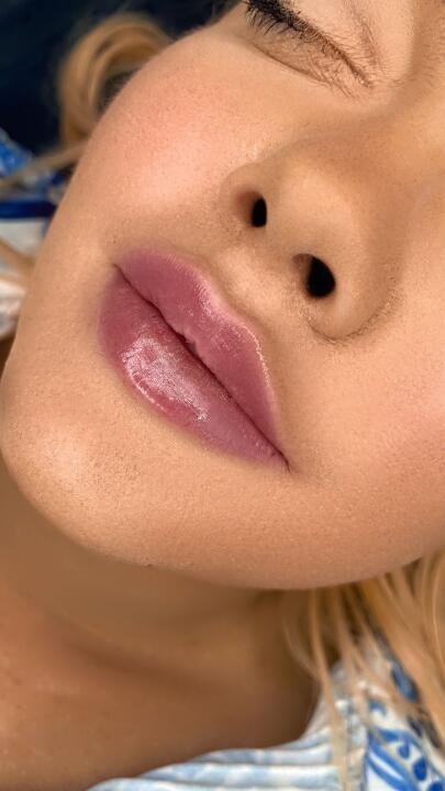 Millie Green Aesthetics and beauty image 2