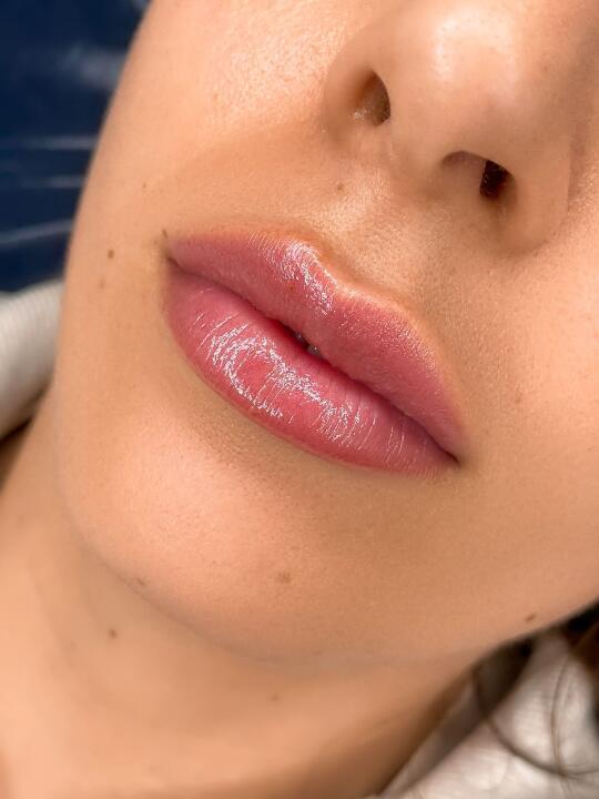 Millie Green Aesthetics and beauty image 1