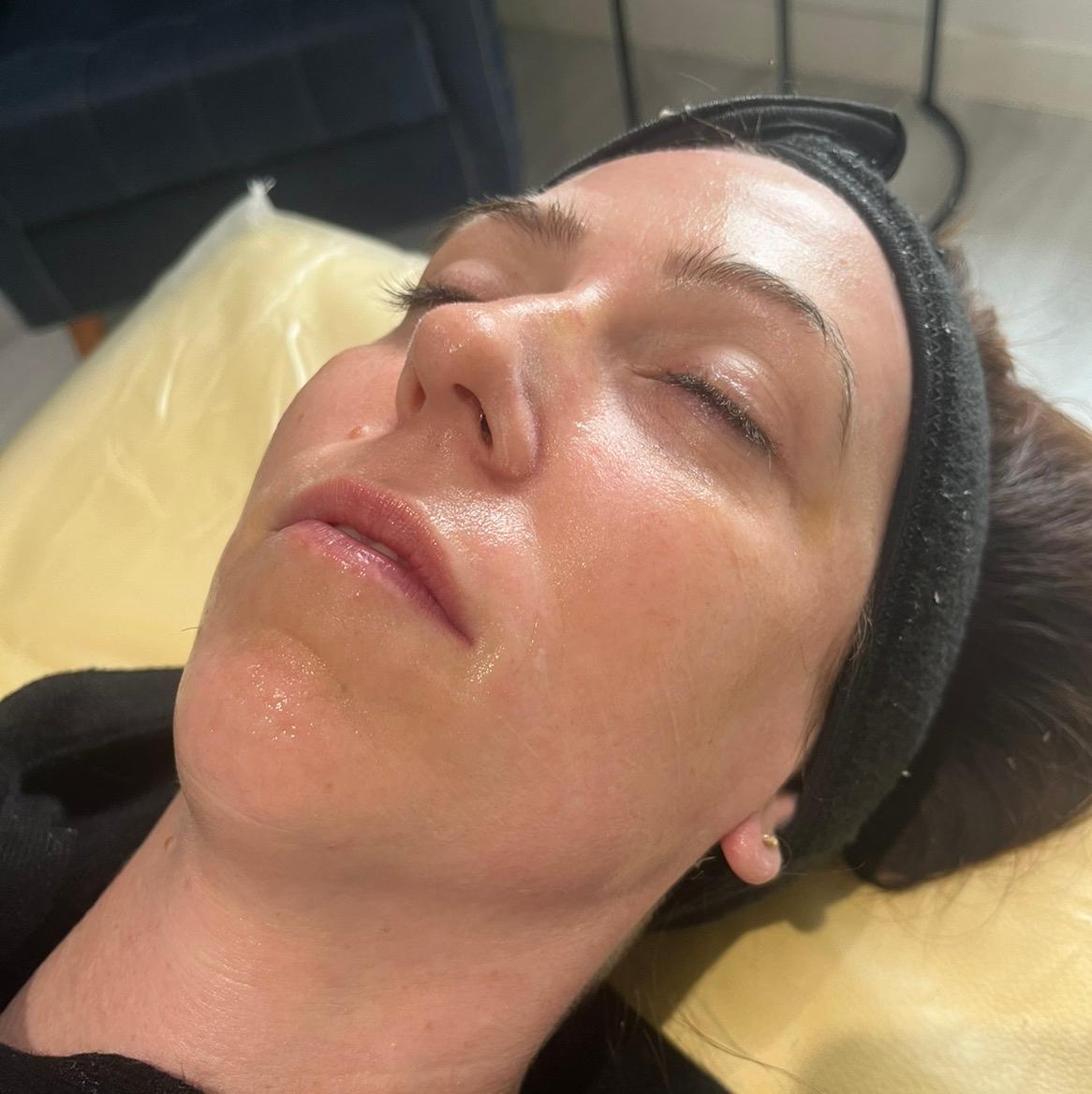 Barefaced aesthetics image 2