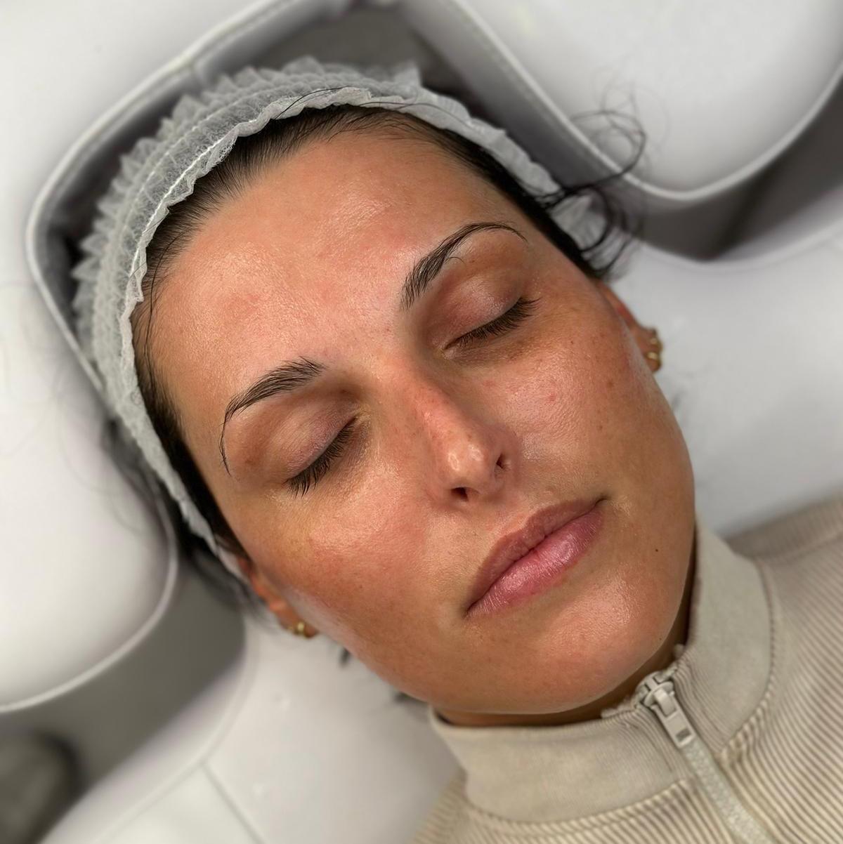 Belleame skin aesthetics clinic image 2