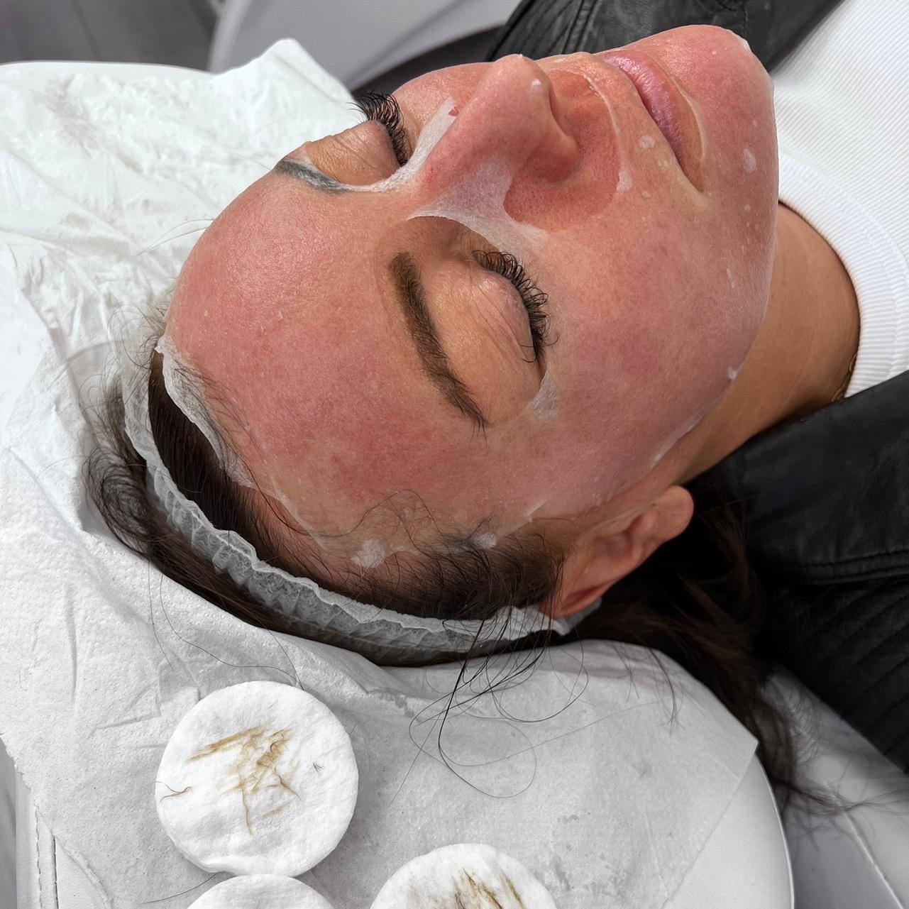 Belleame skin aesthetics clinic image 3