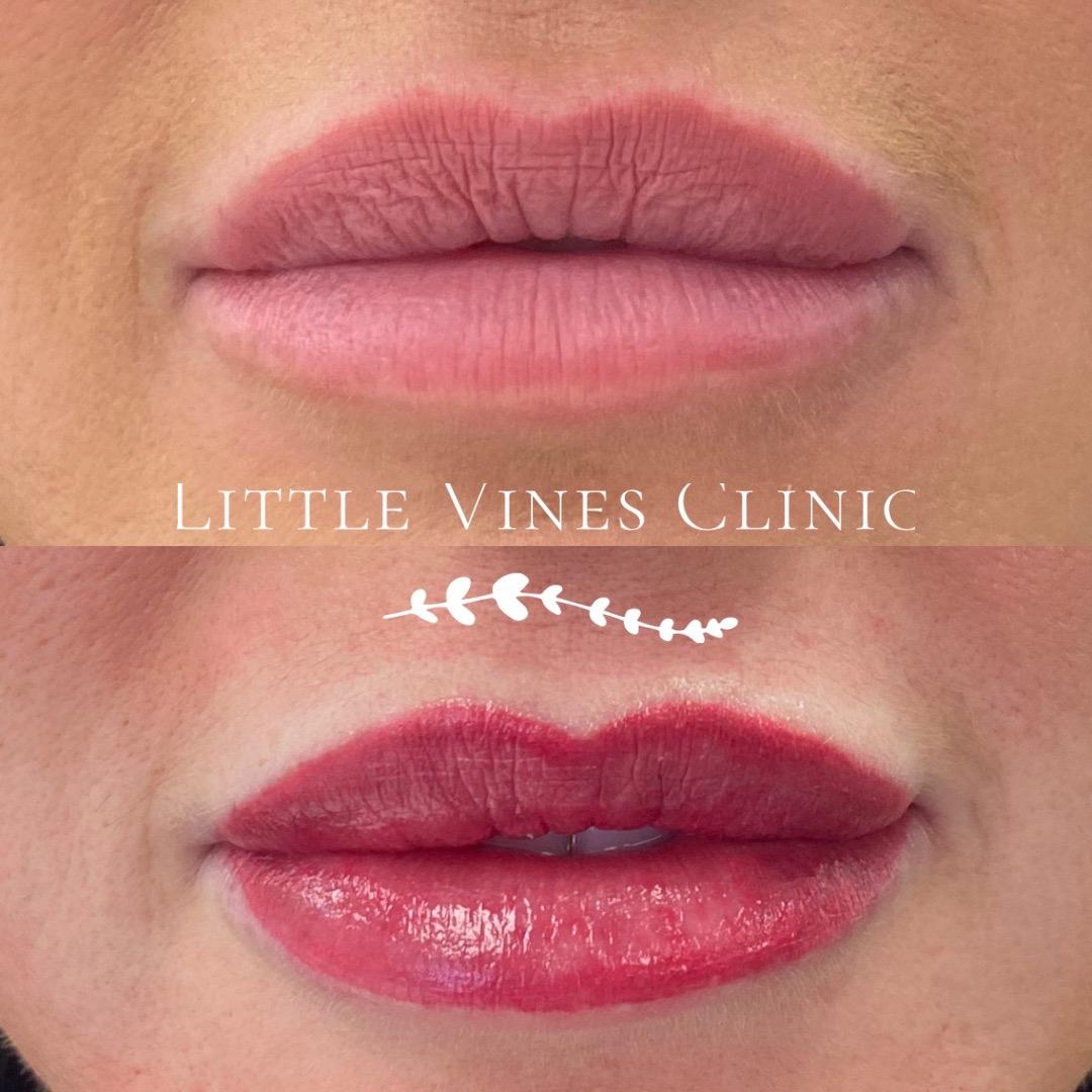 Little Vines Clinic image 3