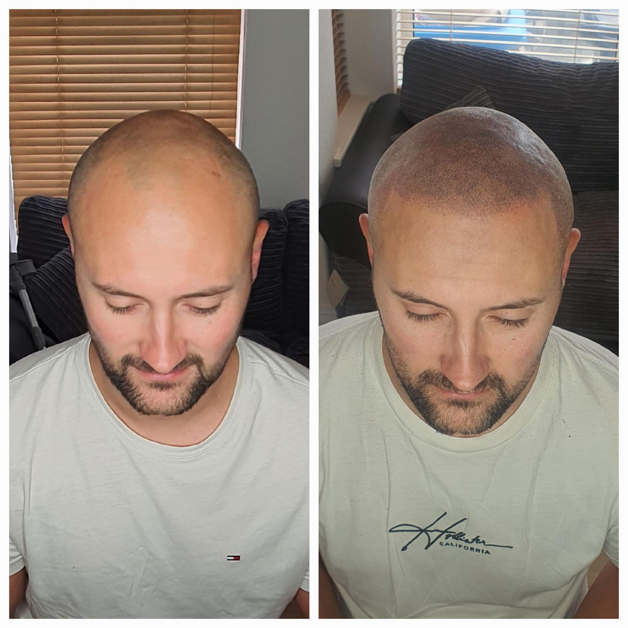 Scalp Line image 1