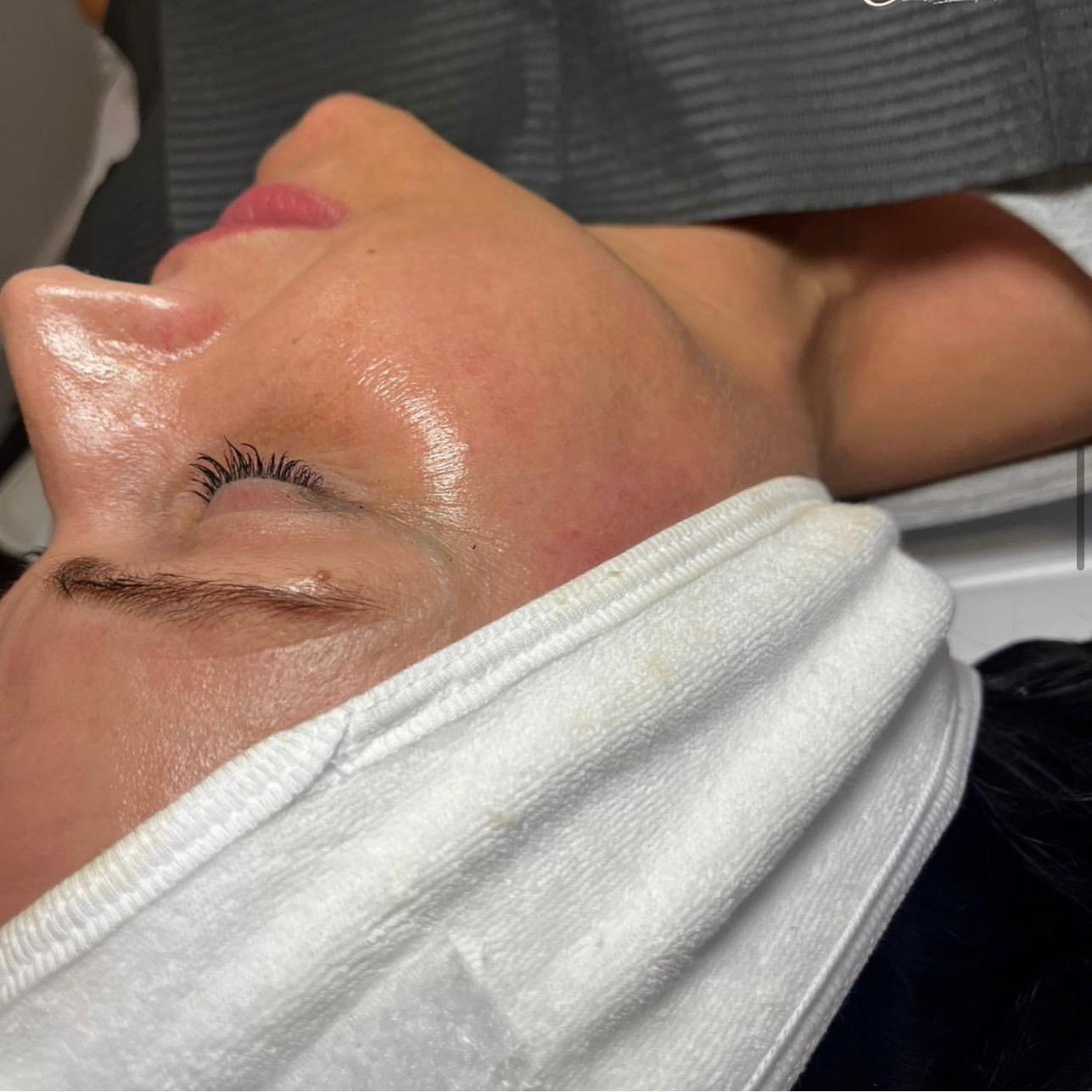 The Rejuvenation Clinic MK image 3
