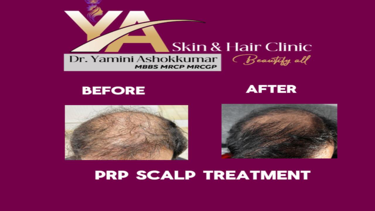YA Skin, Hair and Laser Clinic  image 3