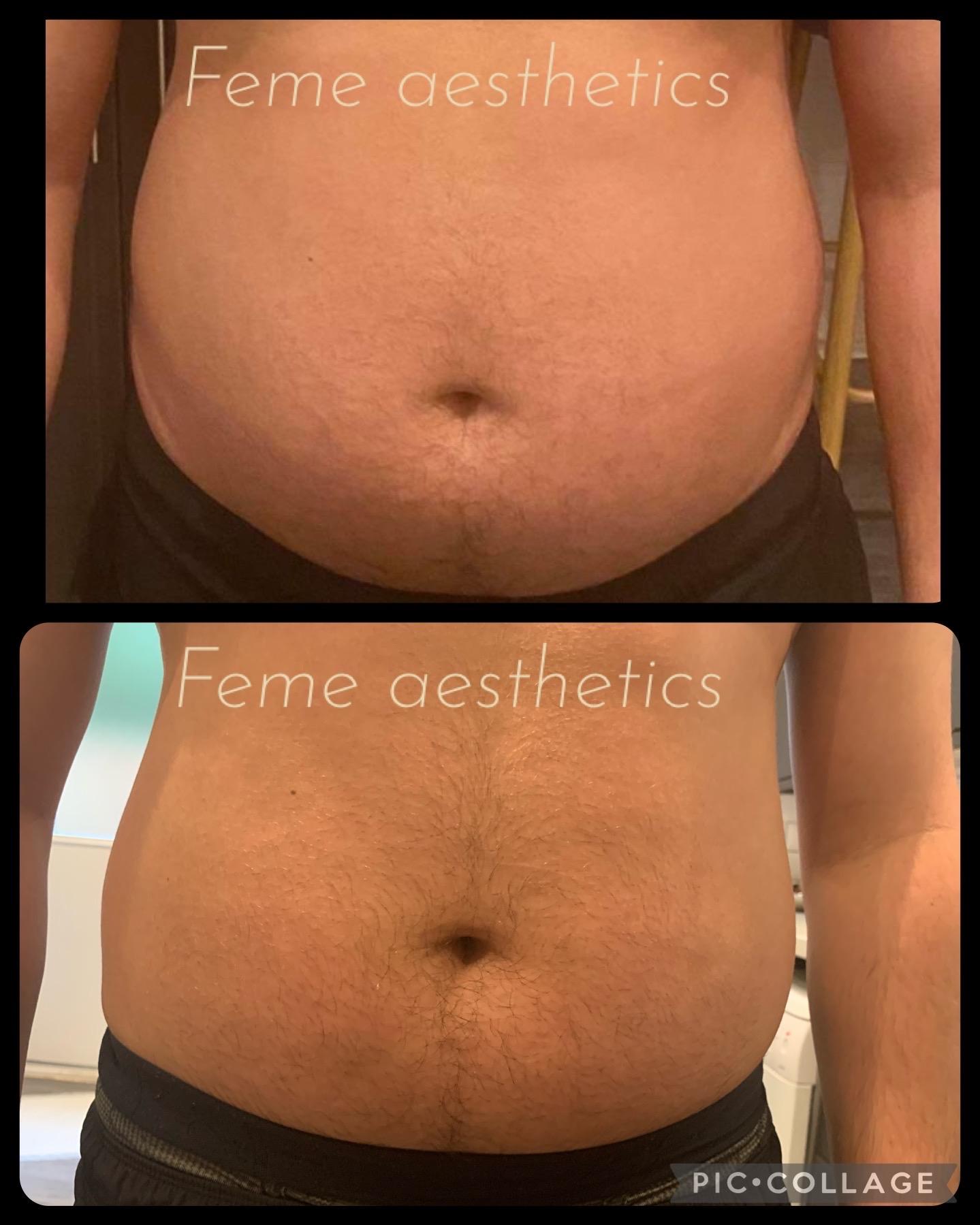Feme aesthetics image 3
