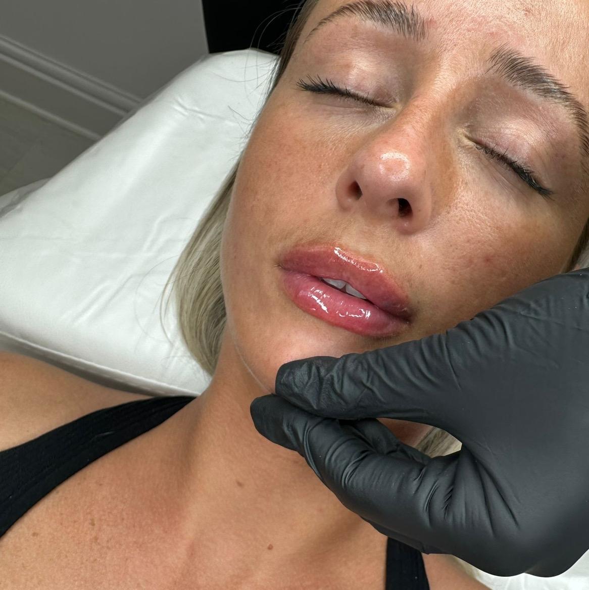 Lavella aesthetics image 2