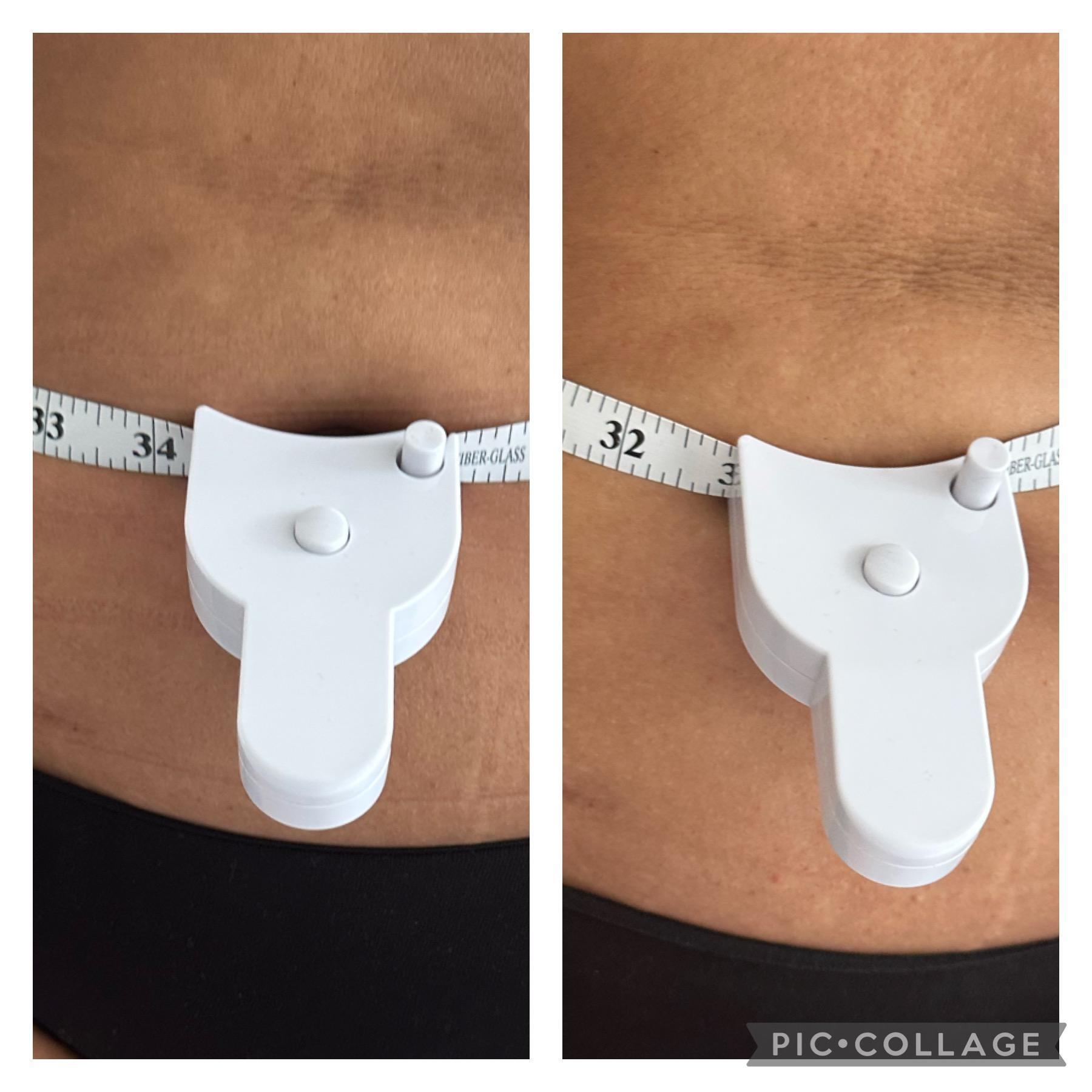 Elegant touch wood therapy body contouring image 1