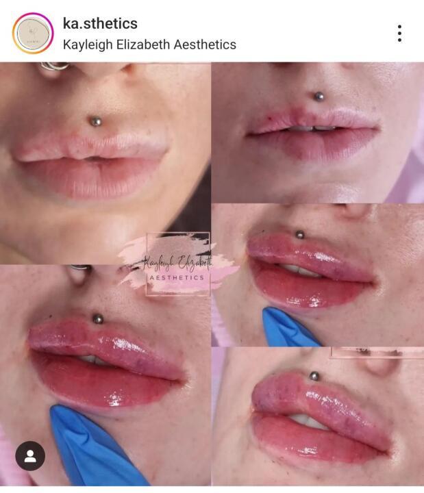 Kasthetics image 2