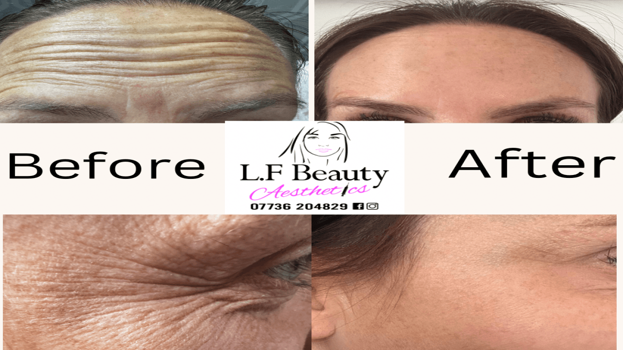 L.F Beauty Aesthetics image 3