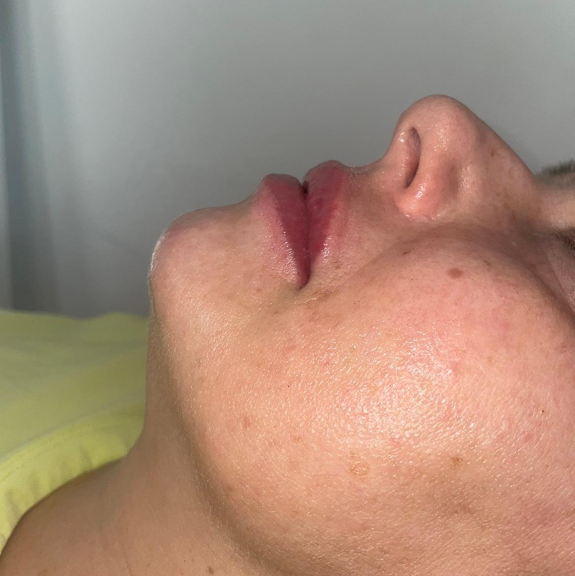 Lina’s Beauty Aesthetics image 2