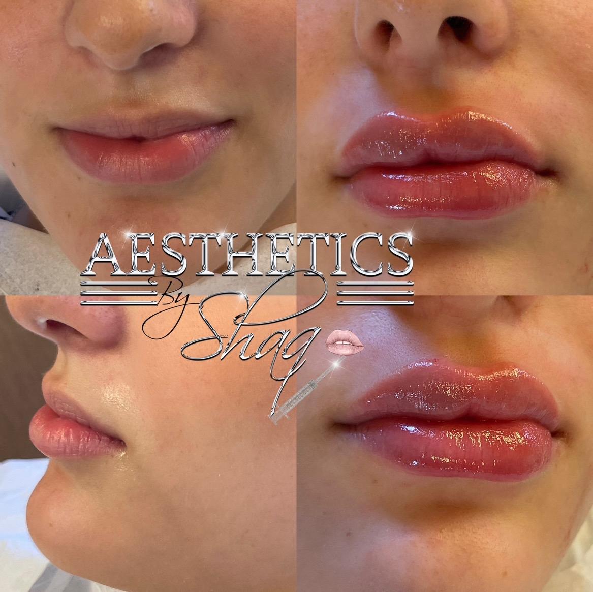 Aesthetics By Shaq image 3