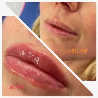 Skin & Blister image 3