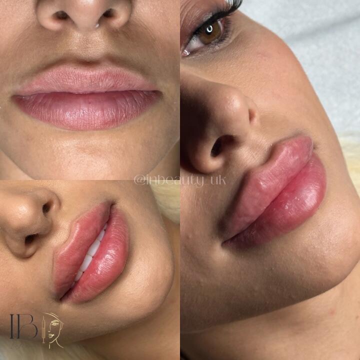 InBeauty Iuliana Aesthetics LTD image 2